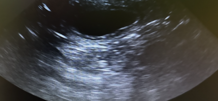 Březost potvrzena!!!